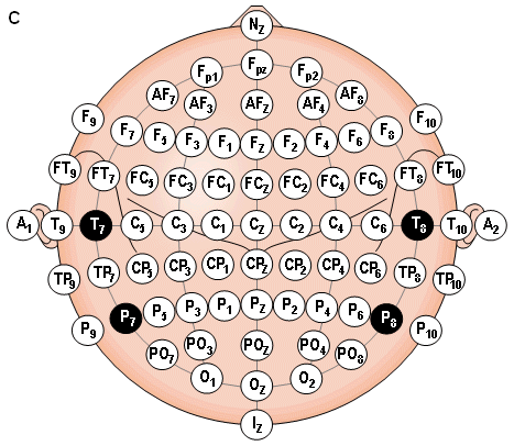 International Model 10-20